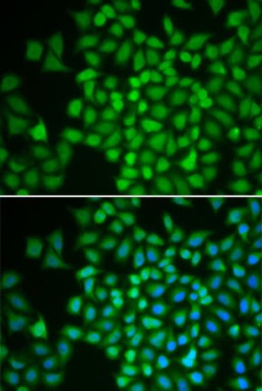 COPS5 / JAB1 Antibody