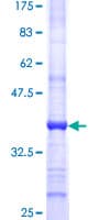 Human SMARCAL1 Protein (Recombinant GST, N-terminus)