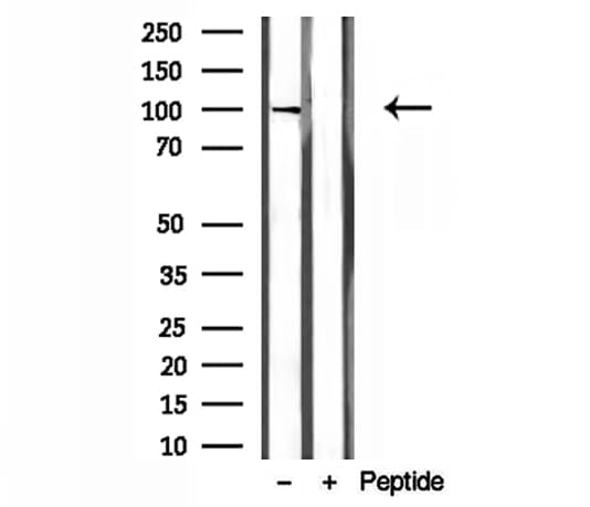 Polyclonal Rabbit anti-Human NOD2 / CARD15 Antibody (IHC, IF, WB)
