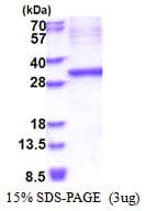 Human KLK15 / Kallikrein 15 Protein (Recombinant His)