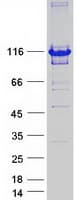 Human PPP1R9B / Spinophilin Protein (Recombinant Myc-DDK (Flag))