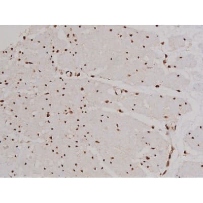 FAK / Focal Adhesion Kinase Antibody (phospho-Tyr397)