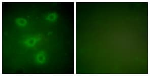 KRT14 / CK14 / Cytokeratin 14 Antibody (aa1-50)
