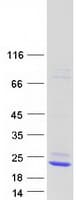 Human LCN15 Protein (Recombinant Myc-DDK (Flag))