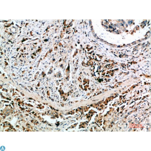 Polyclonal Rabbit anti-Human NANOS1 / NOS1 Antibody (WB)