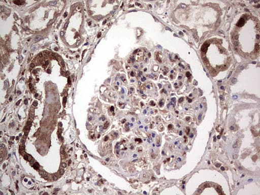 Monoclonal Mouse anti-Human LGALS3 / Galectin 3 Antibody (clone OTI15E4, IHC, WB)