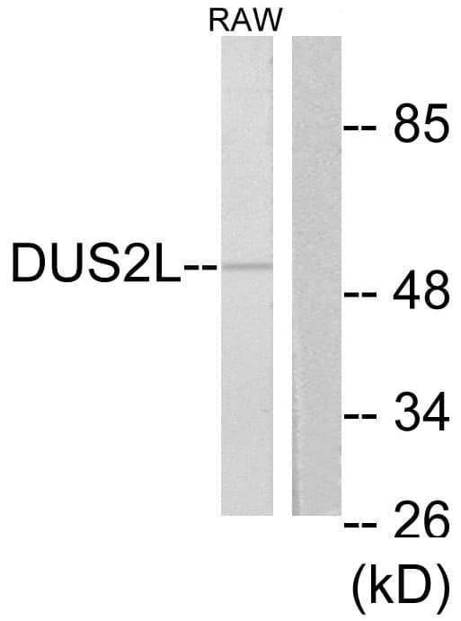 DUS2 / DUS2L Antibody (aa421-470)