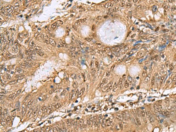 PSMA6 Antibody