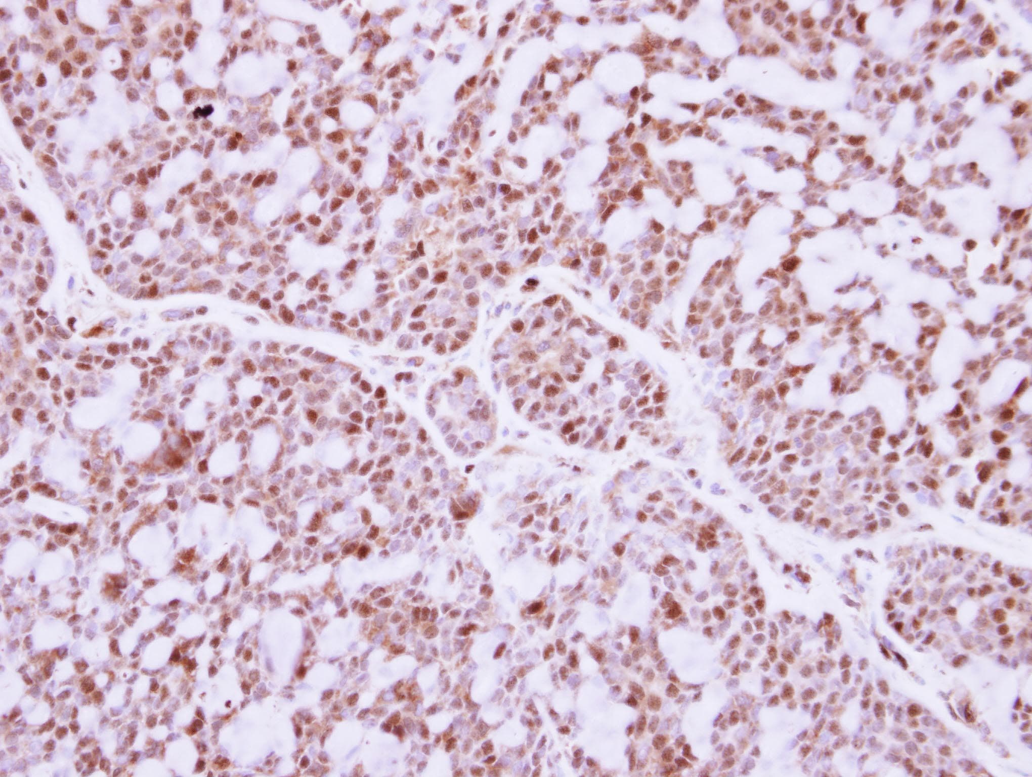 ISGF3 / IRF9 Antibody