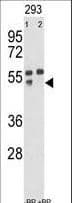 MMP12 Antibody (aa391-420)