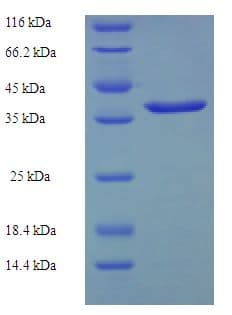 Human CSRP2 Protein (Recombinant His-SUMO)