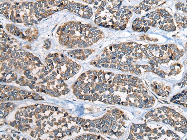 CADM2 Antibody