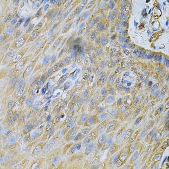 PDGF-BB Antibody