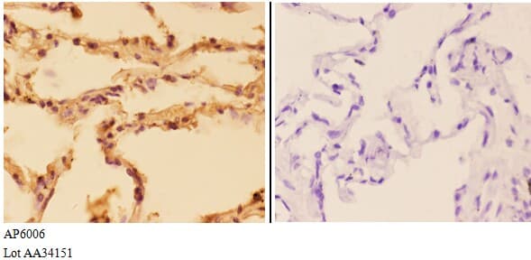 Polyclonal Rabbit anti-Human SQSTM1 Antibody (IHC, WB)