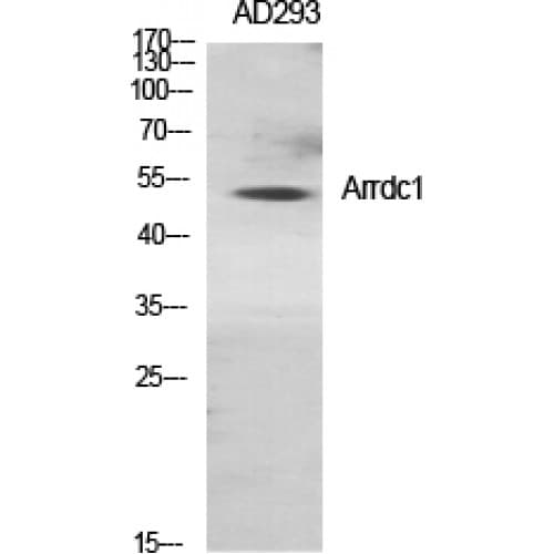 Polyclonal Rabbit anti-Human ARRDC1 Antibody (140-220 aa, Internal, WB)