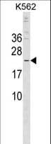 Polyclonal Rabbit anti-Human CRYBB3 Antibody (aa179-207, WB)