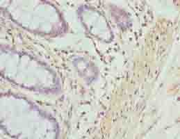 ACTG2 Antibody