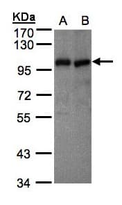 IHC-plus™ VAV1 / VAV Antibody (aa83-568)