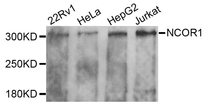 Polyclonal Rabbit anti-Human N-CoR / NCOR1 Antibody (IHC, IF, WB)