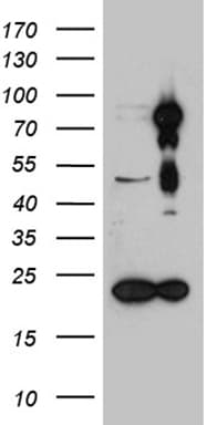 Monoclonal Mouse anti-Human HDAC9 Antibody (clone OTI1H4, Carrier-free, aa181-460, WB)