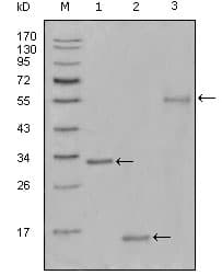 NIFK / MKI67IP Antibody (clone 9C12B2)