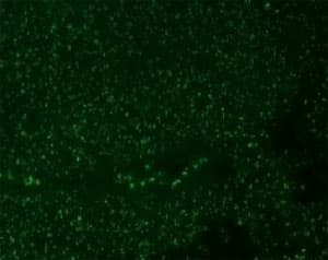 Nucleolar Antigen Antibody (clone NCM102-1)