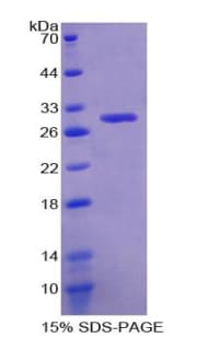 Mouse GSTT1 Protein (Recombinant His-T7)