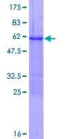 Human Loricrin Protein (Recombinant GST)