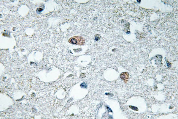 SYN1 / Synapsin 1 Antibody (phospho-Ser9)