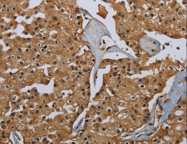 Polyclonal Rabbit anti-Human GBP5 Antibody (IHC)