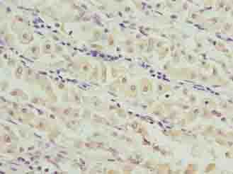 GAJ / MND1 Antibody