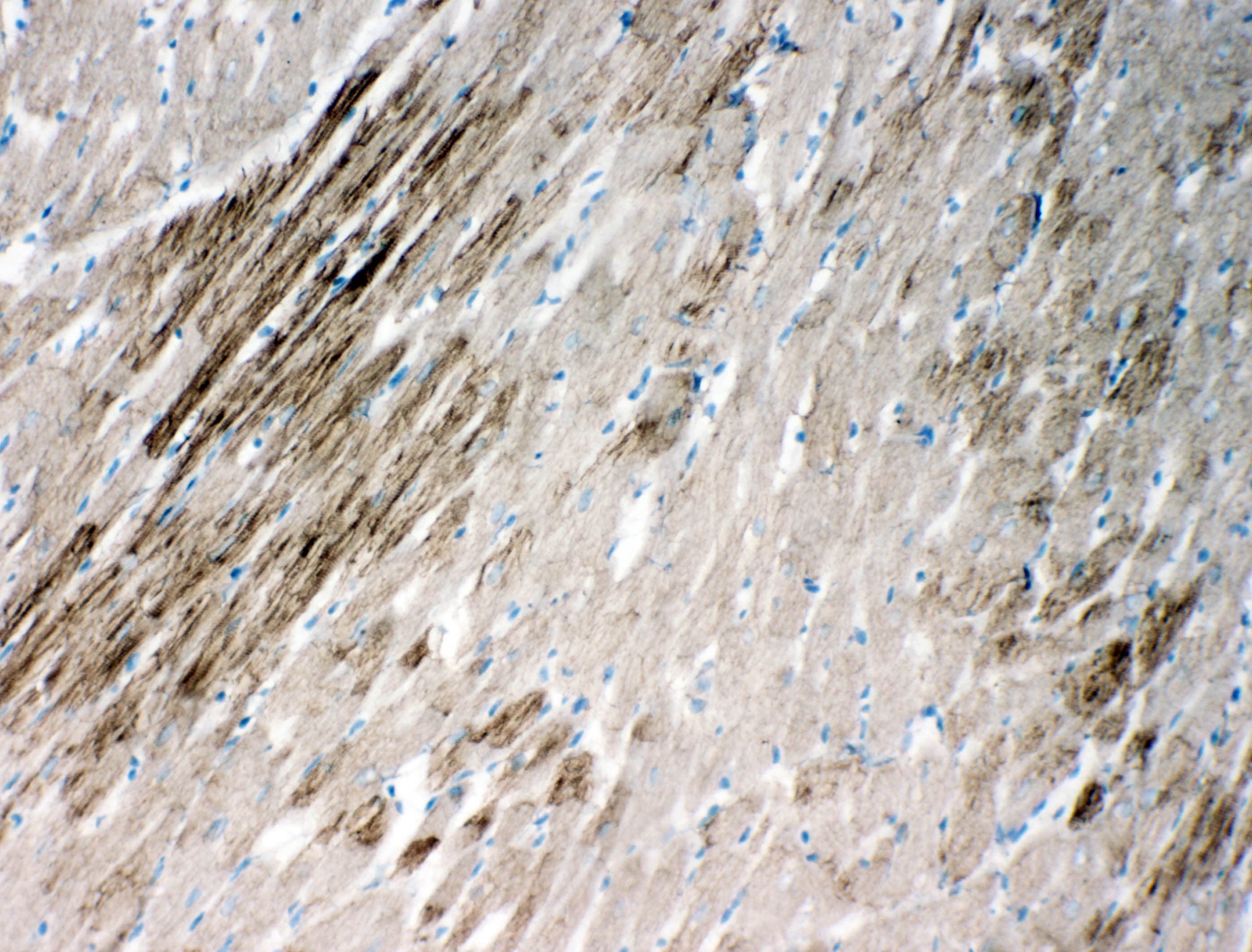 HSPB2 / HSP27 Antibody (aa102-118)