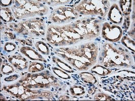 ACAT2 Antibody (clone OTI1B7)