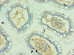 Polyclonal Rabbit anti-Human TRAF5 Antibody (aa1-300, IHC)