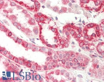 DLST / E2 Antibody (aa340-389)
