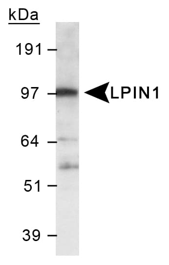 LPIN1 / Lipin 1 Antibody (Internal, DY488)