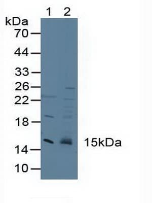 CST3 / Cystatin C Antibody (aa27-146)