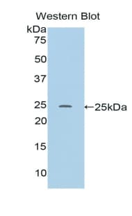 RIP1 / RALBP1 Antibody (aa192-380)