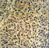 Polyclonal Rabbit anti-Human FUT6 Antibody (aa102-130, IHC, WB)