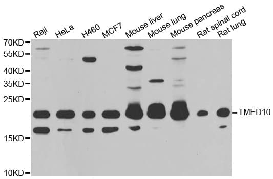 TMED10 / TMP21 Antibody