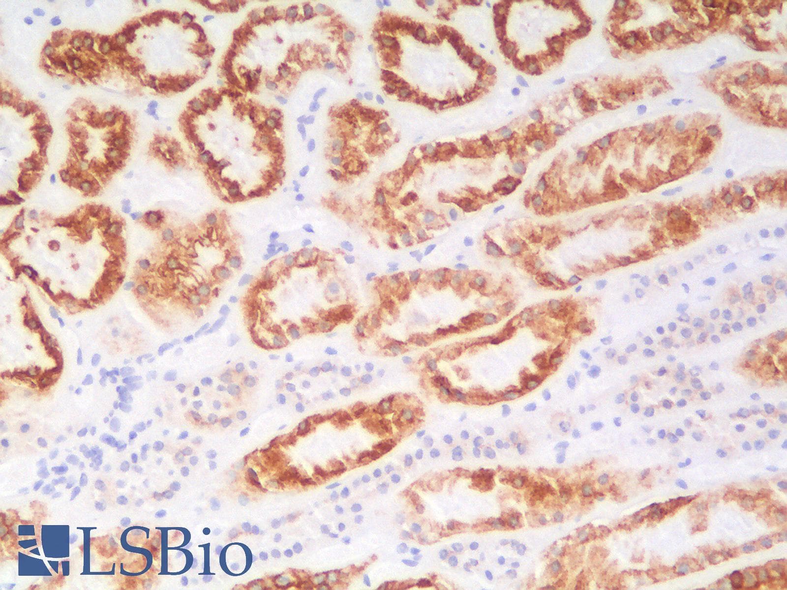 PathPlus™ Recombinant Monoclonal Rabbit anti-Human KRT18 / CK18 / Cytokeratin 18 Antibody (clone KRT18/2808R, IHC, IF, WB)