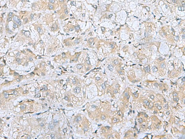 BDNF Antibody
