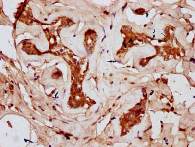 Polyclonal Rabbit anti-Human CDAN1 Antibody (IHC, IF)