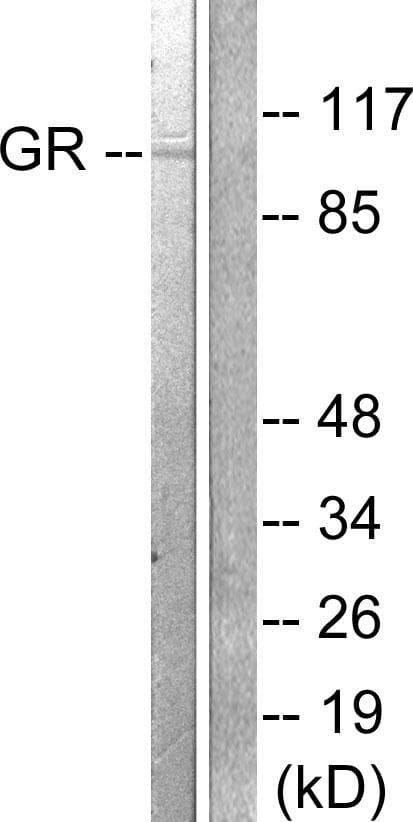 NR3C1/Glucocorticoid Receptor Antibody (p211)