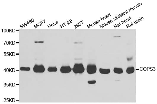 Polyclonal Rabbit anti-Human COPS3 / CSN3 Antibody (IHC, IF, WB)