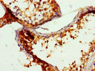 CCDC101 Antibody