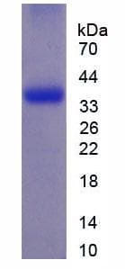 Human DPP / DSPP Protein (Recombinant His, N-Terminal)