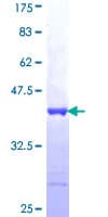 Human FNDC4 Protein (Recombinant GST, N-terminus)
