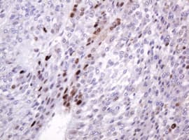 PCNA Antibody (clone OTI4B2)