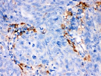 FCGRT / FCRN Antibody